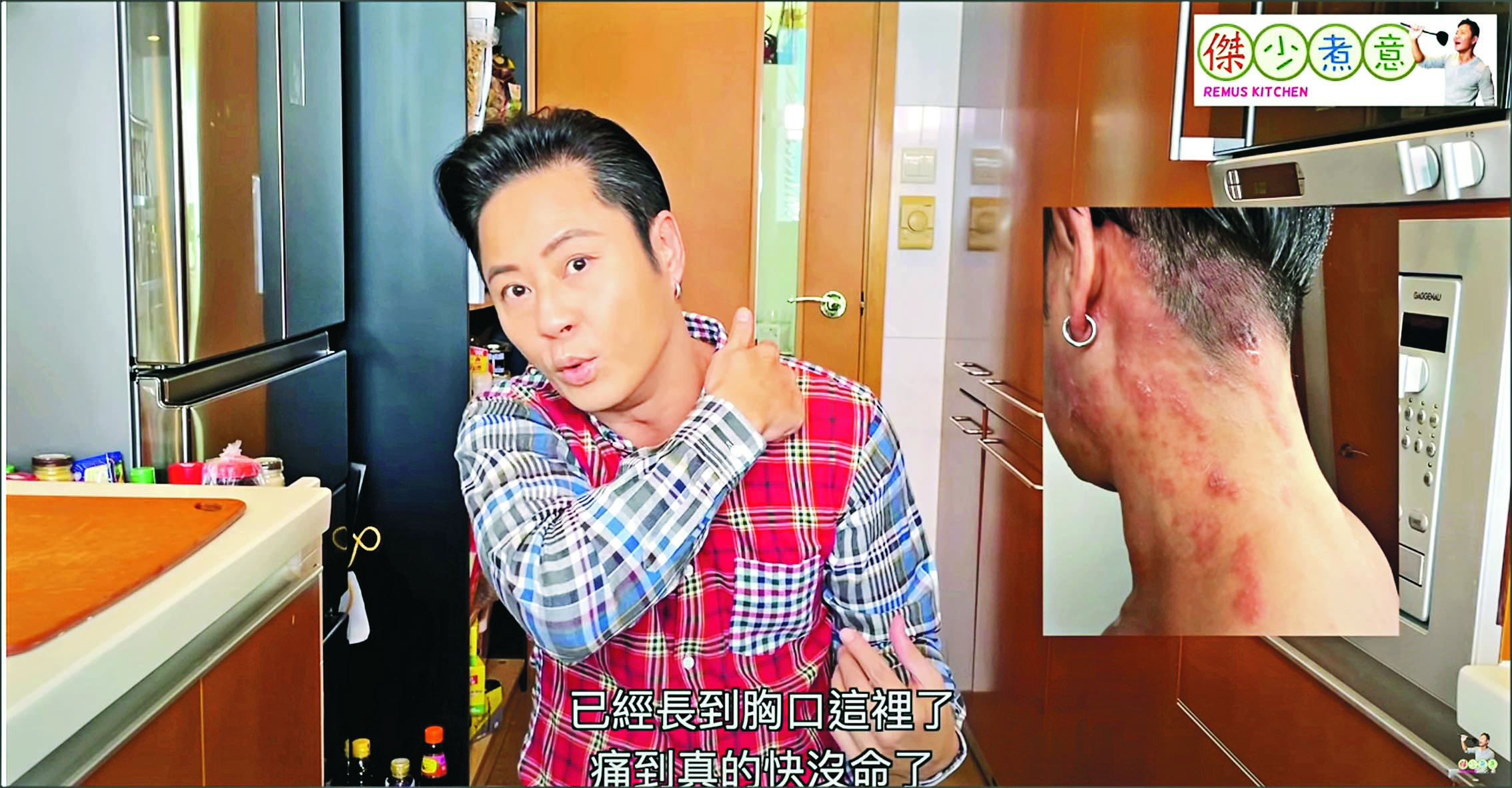 生蛇撞正8号风球 蔡一杰痛饿交迫