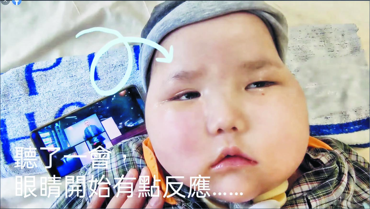 姜涛歌声令6岁植物人有反应