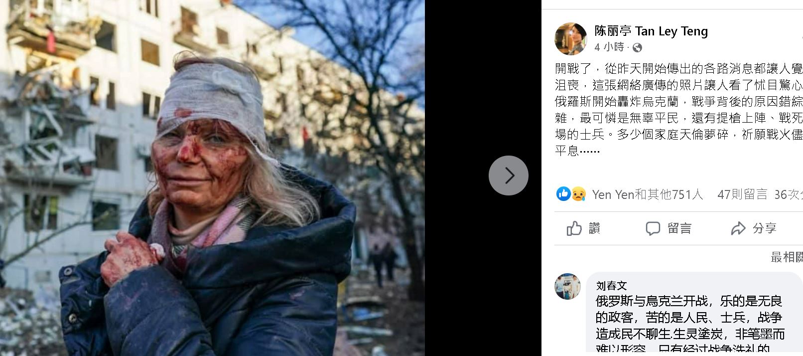 俄乌开战老百姓最伤 艺人痛心:可以不要打仗吗