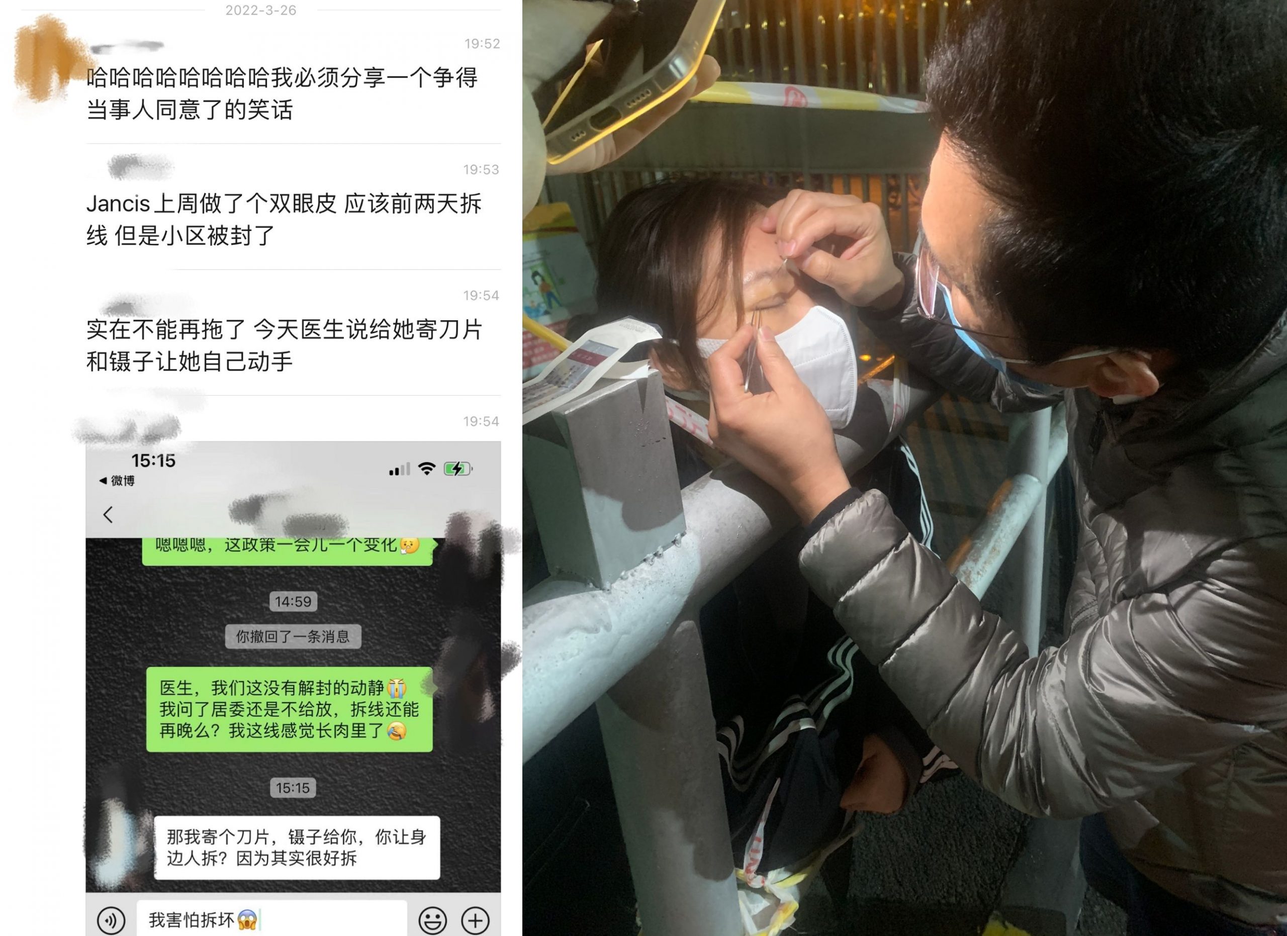 上海女子割双眼皮后小区被封控 术后第9天医生带工具隔栏拆线