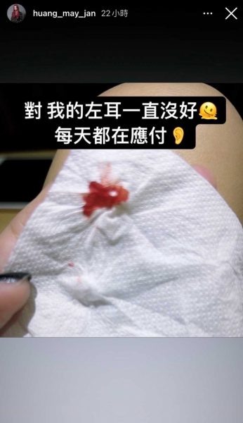 左耳流血流脓好不了 黄美珍放宽心共存