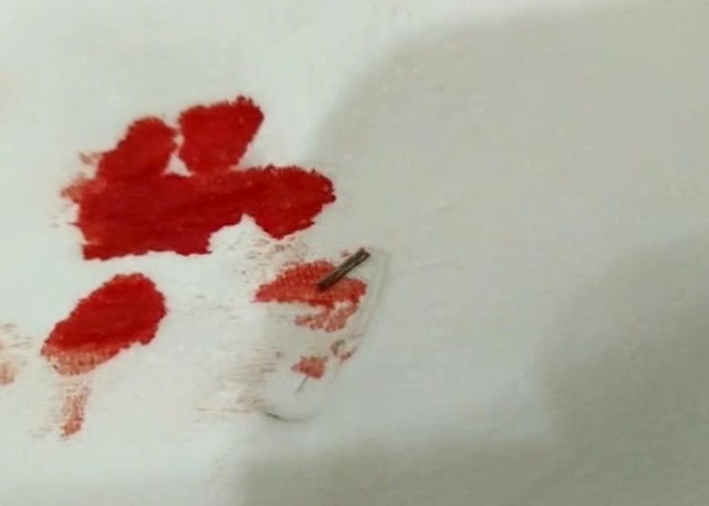 拼盘/女子谎称外卖吃出铁丝索赔 多间商店受骗