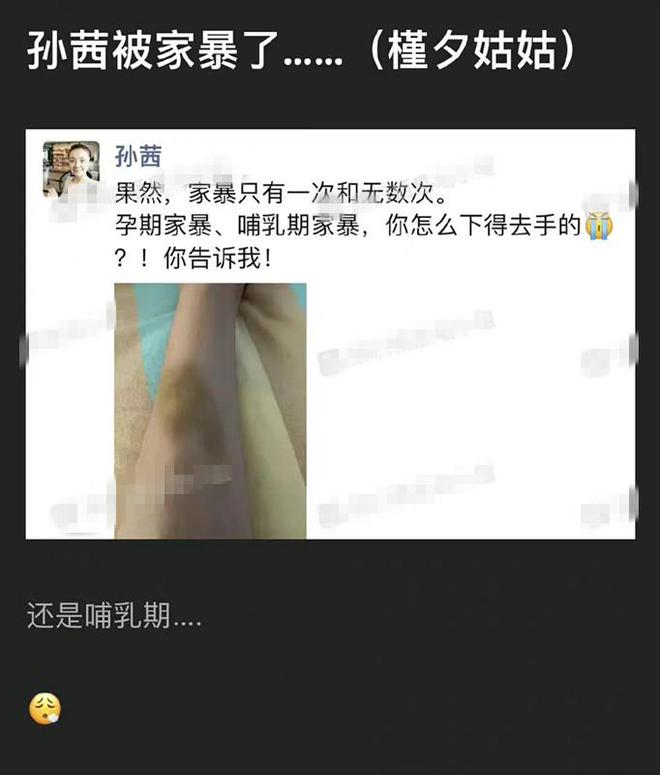 孙茜晒图遭疑孕期遭家暴 澄清非本人被亏想上热搜