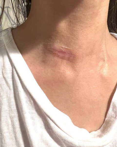 34岁女星证实罹癌 泪崩问:为什么是我