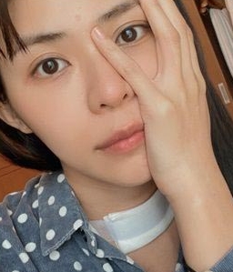《骄女》林萱瑜甲状腺长肿瘤 脖子插引流管崩溃哭