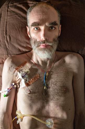 拼盘/罹严重免疫性疾病加州男 自拍《死著活》获金奖