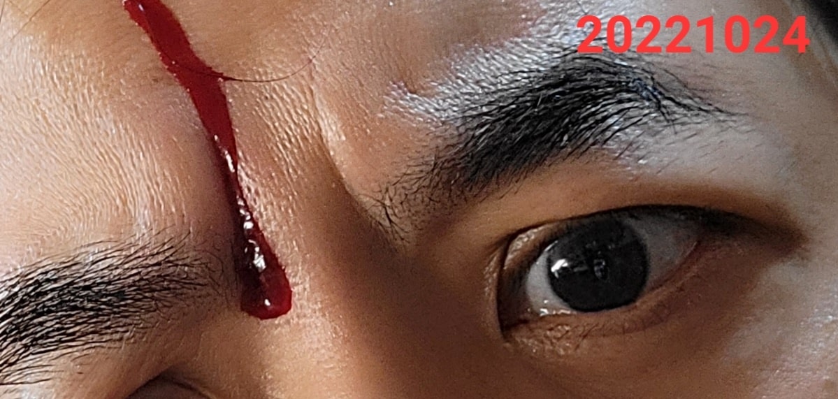黄子佼砸伤头溅血 Lulu惊喊:别卖血换爱马仕