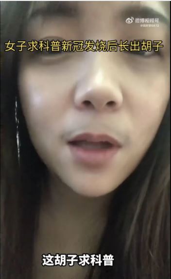 中女子确诊高烧「烧出八字胡」!
