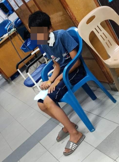 邻居家犬咬伤男童,童父:邻居付20令吉打发