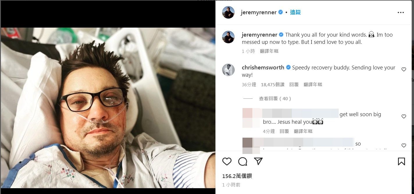 “鹰眼”重伤后首发声 脸肿变形“无法好好打字”