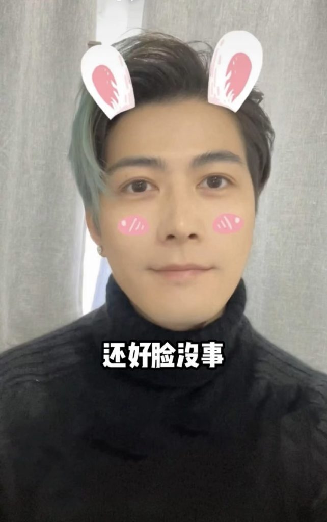 陈学冬出严重车祸 左腿肌肉萎缩坐轮椅