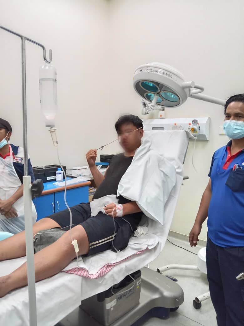 罕见意外!男子鼻子中箭 消拯员断线钳剪断