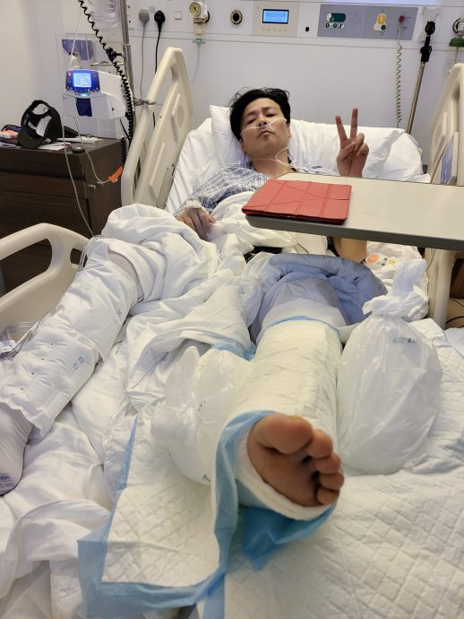 张晋拍戏摔断腿 送院插鼻喉紧急开刀