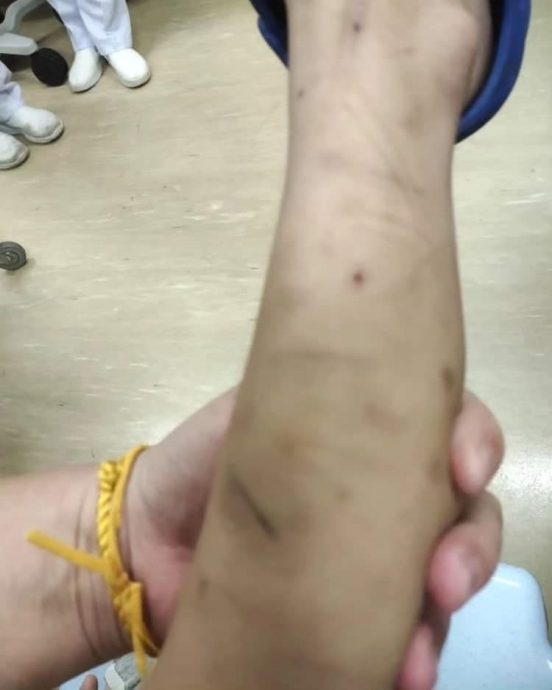 6岁男童疑被生母和男友虐待送院,2涉案者皆已落网