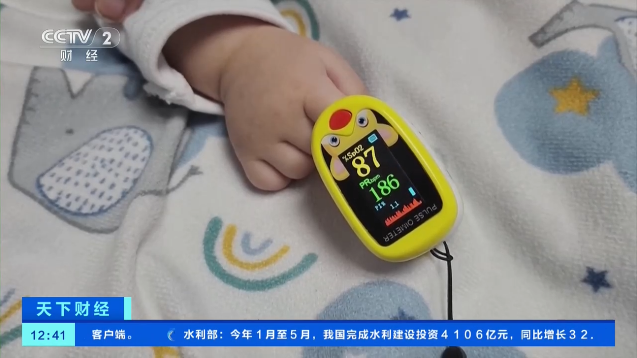智利暴发呼吸道合胞病毒疫情 已致4名婴儿死亡