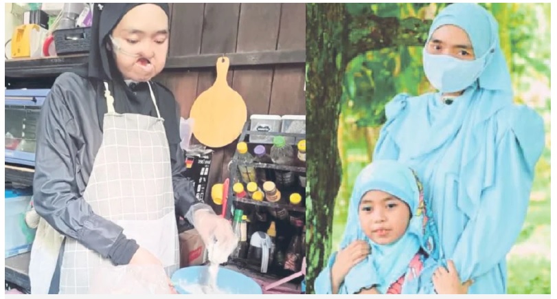 癌夫病逝又患口癌 寡妇咬紧牙根抚养女儿