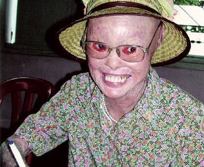 森州淡边新村穿山甲人张四妹走了!