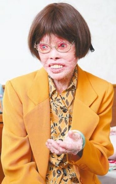 森州淡边新村穿山甲人张四妹走了!