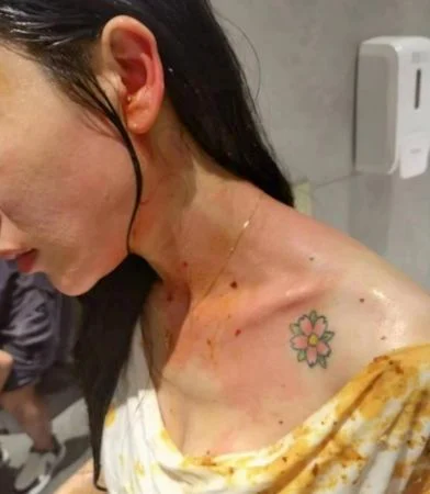 家暴16次 中国女子“终身挂粪袋”还离不了婚