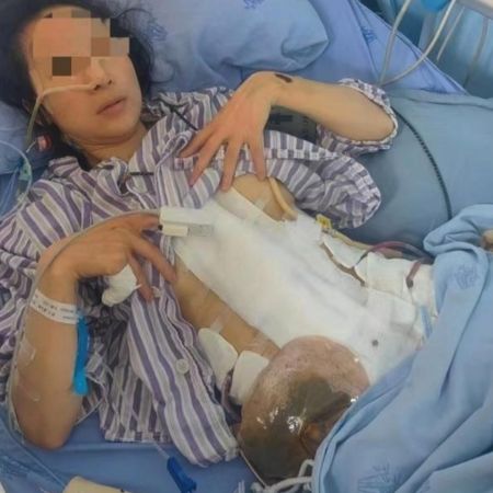 家暴16次 中国女子“终身挂粪袋”还离不了婚