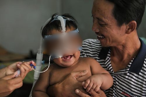 补图/天生有肺病 套呼吸管挤摩托车小童找到了!