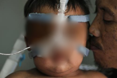 补图/天生有肺病 套呼吸管挤摩托车小童找到了!