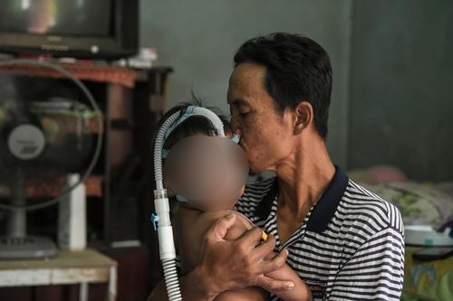 补图/天生有肺病 套呼吸管挤摩托车小童找到了!
