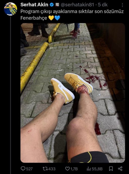 做完足球直播评述遭枪击 前土耳其前锋脚中弹受伤