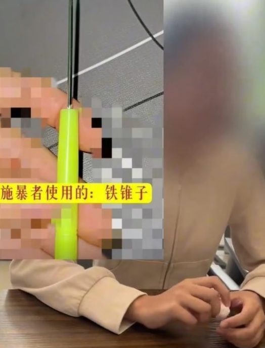 小女生大腿遭同桌男生扎218针 校方竟称“不符合霸凌标准!”