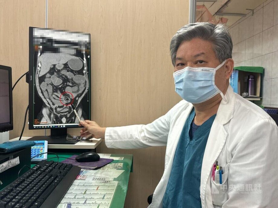 拼盘∕未咬碎吞下 5公分香菇卡小肠男子挨刀