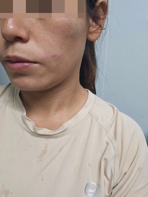 只因替外籍移工叫Grab? 女商人惨遭司机扇脸!