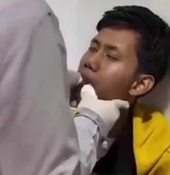 熬夜玩游戏惹的祸? 男子打哈欠下巴脱臼!