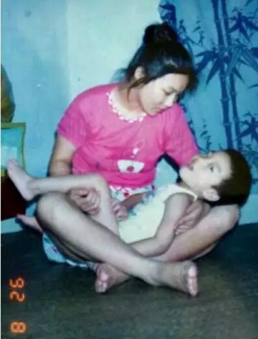 暖势力|“谁敢拔管,我就拼命!” 母亲30年苦撑 把脑瘫儿送进北大哈佛