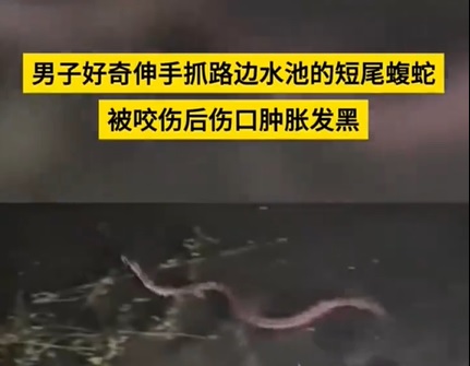 供Newswire:视频|男子好奇抓短尾蝮蛇被咬 手肿胀发黑急送医