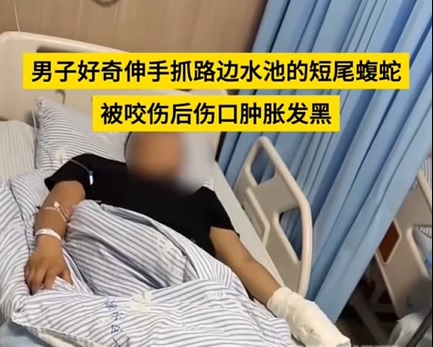 供Newswire:视频|男子好奇抓短尾蝮蛇被咬 手肿胀发黑急送医