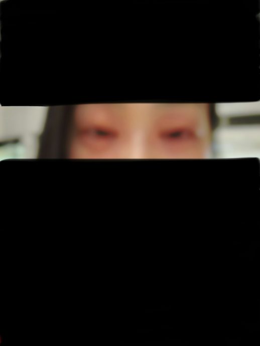 郭柏妍食物敏感眼部红肿 气管收缩:喘不过气