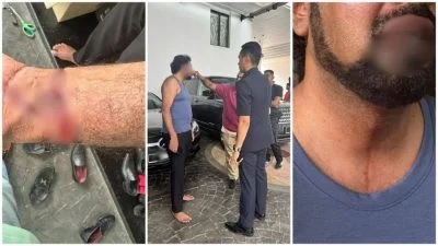 林冠英海底隧道案|震惊证人遇袭遭警方定性抢劫 律师:他被威胁不要逞英雄!