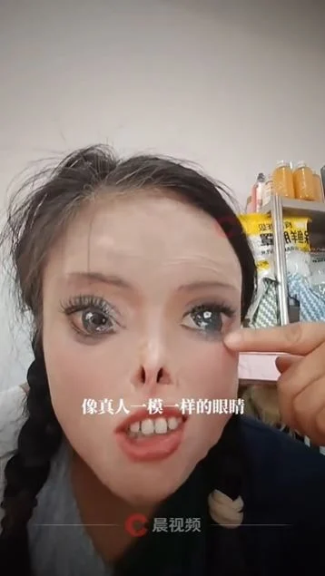 (已签发)中国女子被泼硫酸毁容 自学画画重塑五官