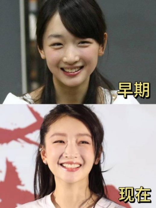被杜海涛贴脸问“是否整容” 周冬雨亲揭眼变大真相
