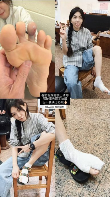 Ella开工即受伤溅血 自嘲脚趾罢工