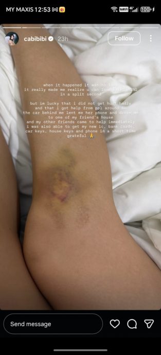 蒲种山庄油站现掠夺匪 女子添油时被拽倒在地