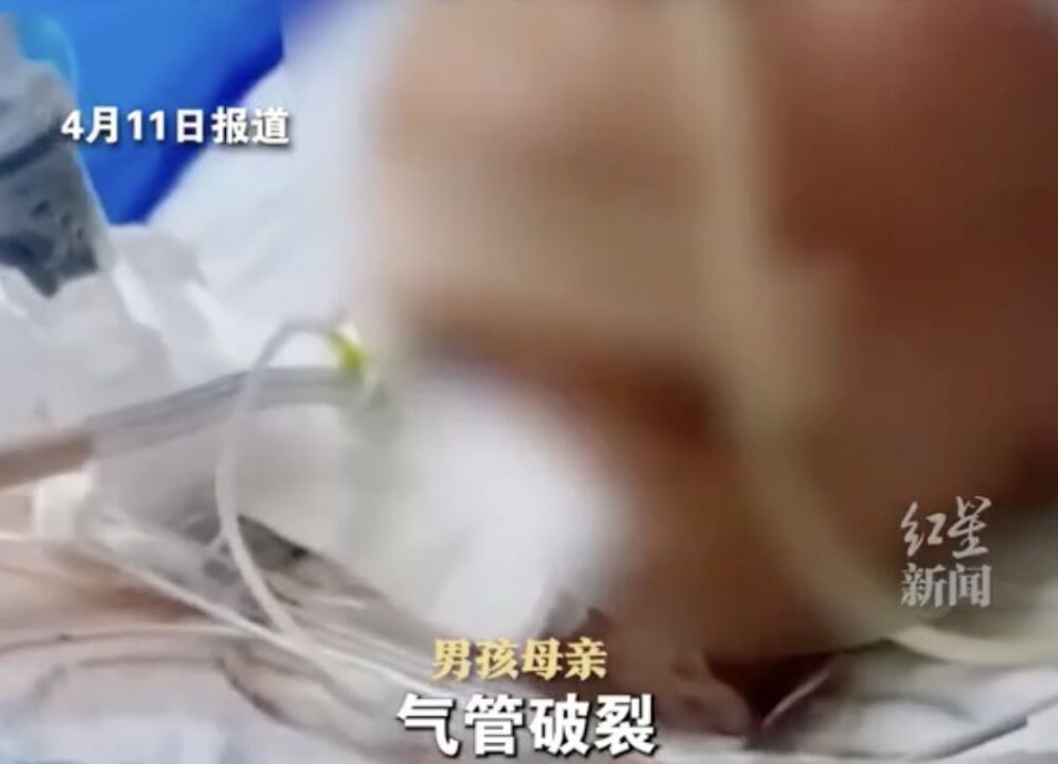 河南村民“拉绳拦路”致13岁少年骑车遭断喉 转院北京抢救仍在ICU
