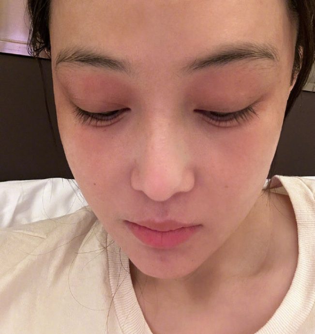 杨幂拍戏惊传险毁容 苦喊:蒸汽眼罩咬我