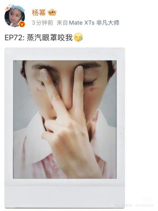 杨幂拍戏惊传险毁容 苦喊:蒸汽眼罩咬我
