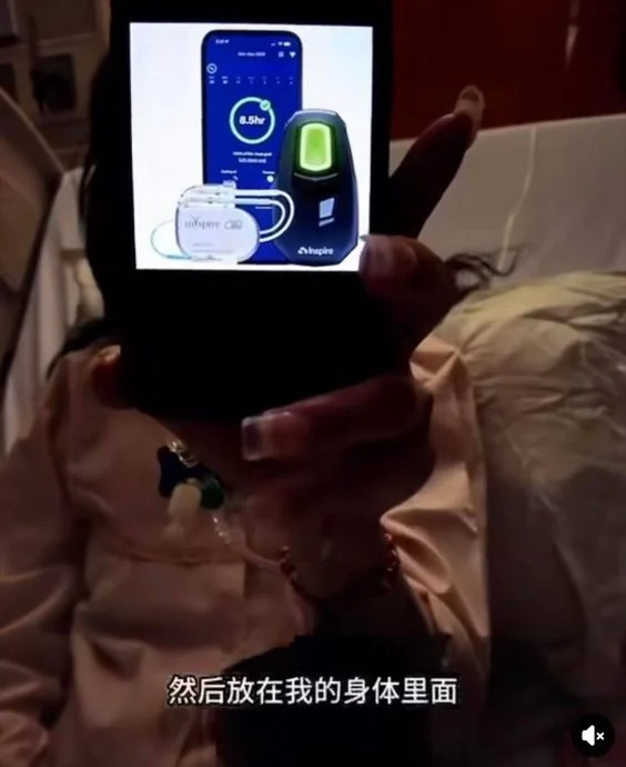 患睡眠呼吸中止症面临猝死风险 江梦蕾舌下植刺激器续命