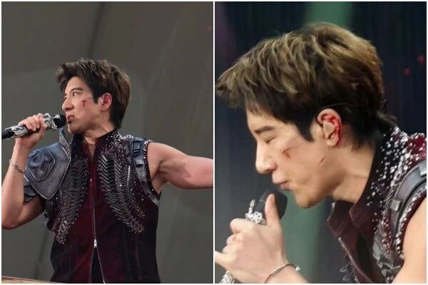 成都演唱会失足重摔 王力宏左脸耳朵全是血