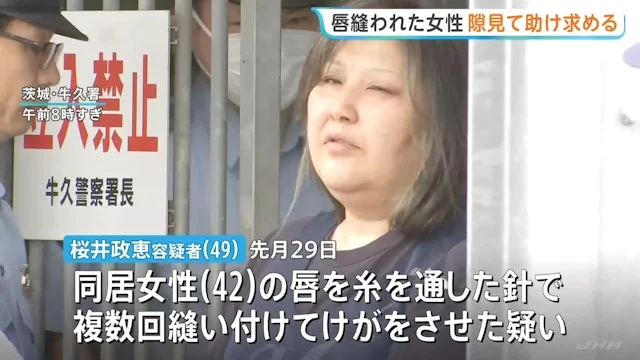 日本惊悚虐待案 42岁女惨遭“针线缝嘴” 逃入店舖靠纸条求救