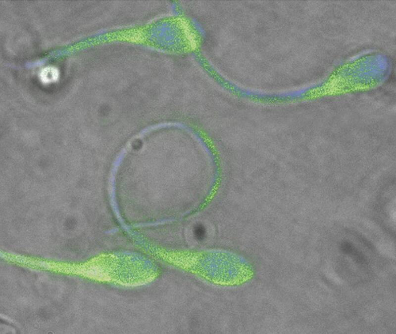 美国研究:空污影响精子DNA 降低男性生育力