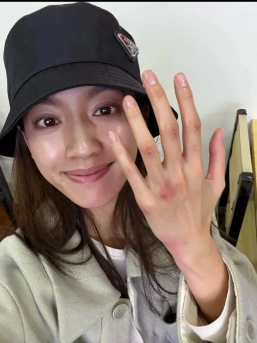 蔡思贝拍《功夫女足》满手瘀伤 周星驰自爆被张小斐“调教”