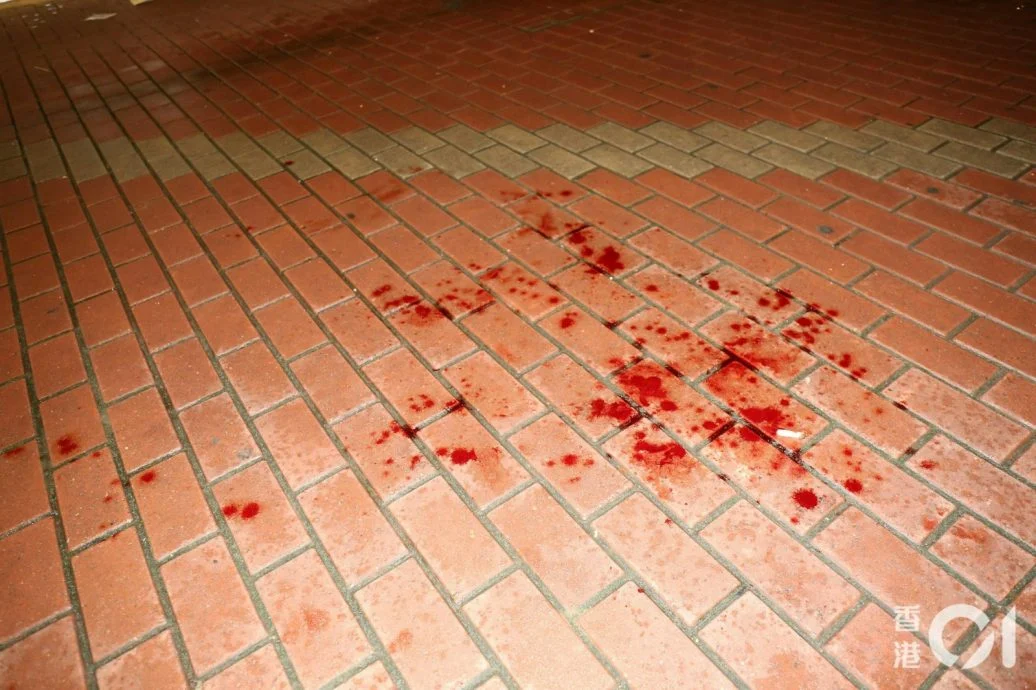 访港买春惊见流莺有喉结起争执 大陆游客遭刺颈险丧命